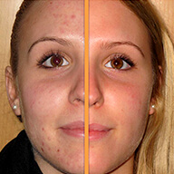 Ir a casos de éxito