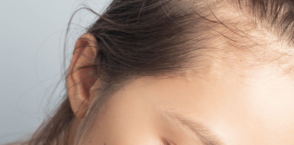 Las mejores vitaminas para la caída del cabello en mujeres: guía experta